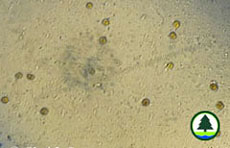 zooxanthellae